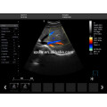 Ultrason médical 3D de Doppler avec le transducteur et le scanner doppler de navire